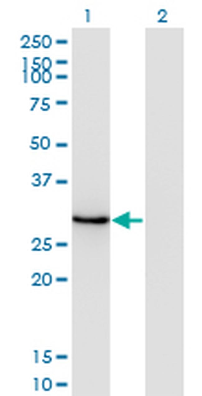 DLX1 Antibody in Western Blot (WB)