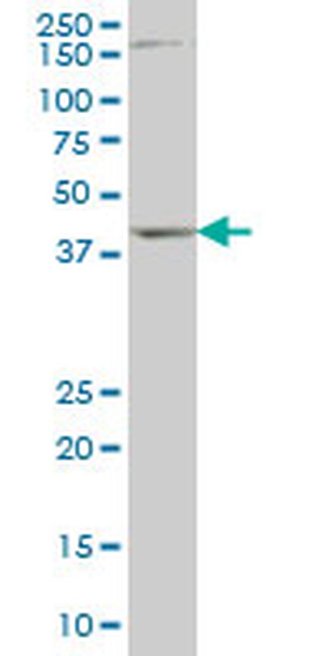 DLX2 Antibody in Western Blot (WB)