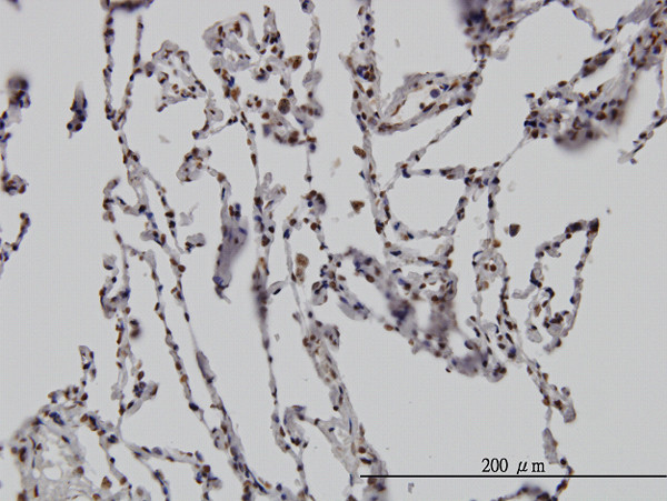 DLX2 Antibody in Immunohistochemistry (Paraffin) (IHC (P))