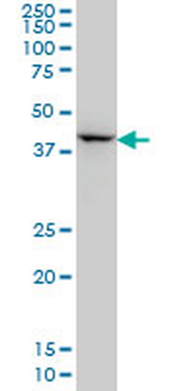 DLX2 Antibody in Western Blot (WB)