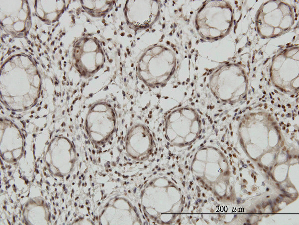 DLX2 Antibody in Immunohistochemistry (Paraffin) (IHC (P))