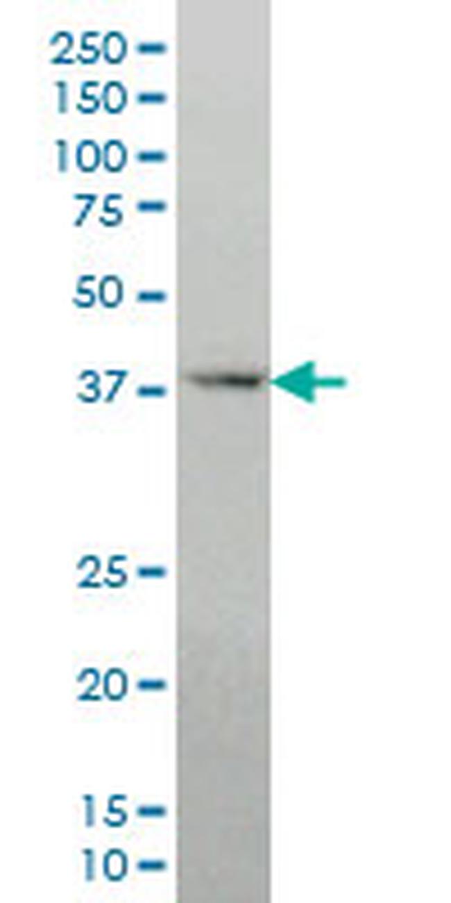 DLX2 Antibody in Western Blot (WB)