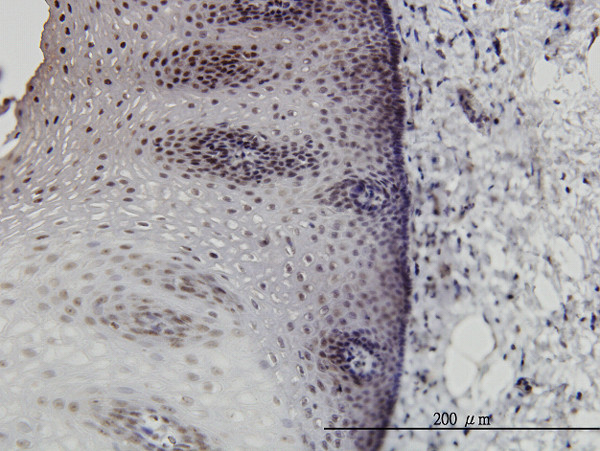 DLX2 Antibody in Immunohistochemistry (Paraffin) (IHC (P))