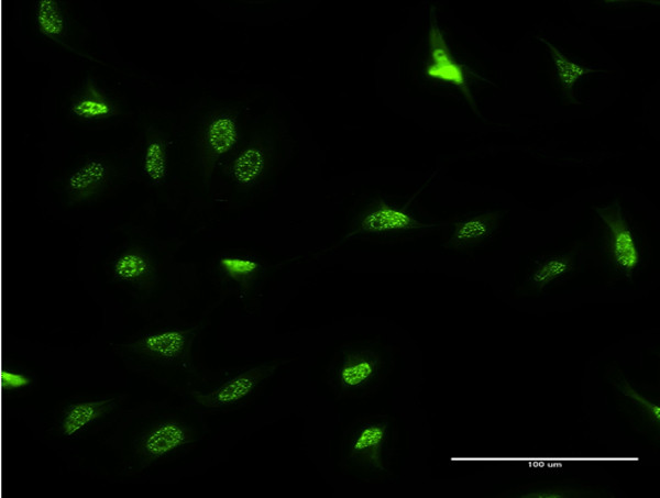 DLX3 Antibody in Immunocytochemistry (ICC/IF)