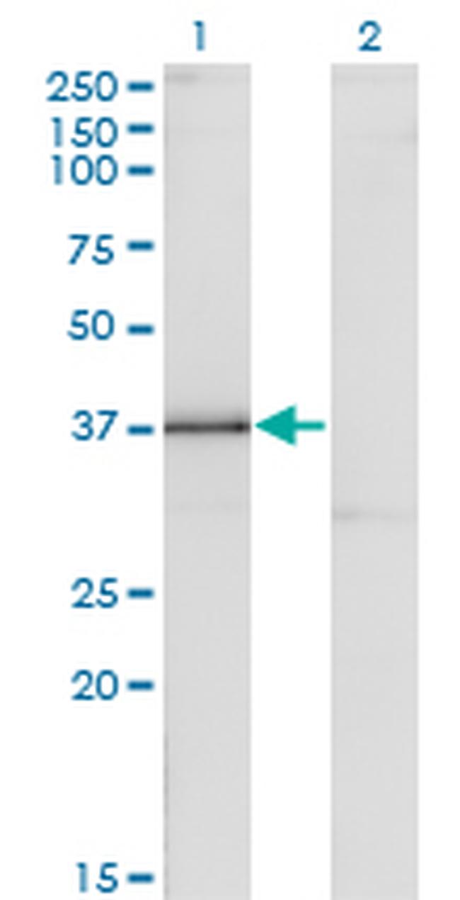 DLX3 Antibody in Western Blot (WB)