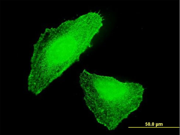 DLX5 Antibody in Immunocytochemistry (ICC/IF)