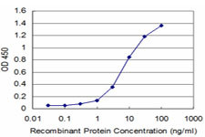 DLX5 Antibody in ELISA (ELISA)