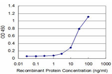 DLX5 Antibody in ELISA (ELISA)