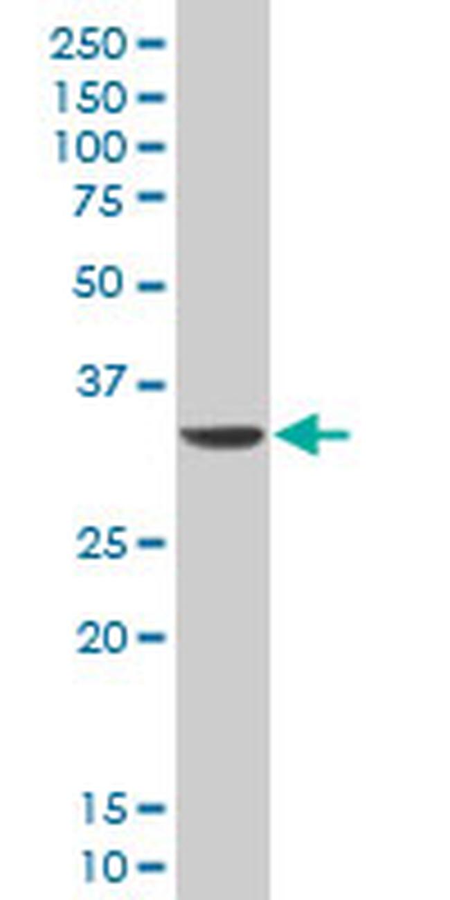 DLX5 Antibody in Western Blot (WB)