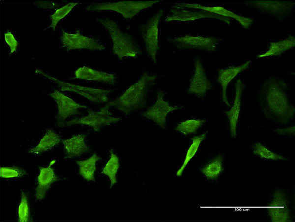 DMP1 Antibody in Immunocytochemistry (ICC/IF)