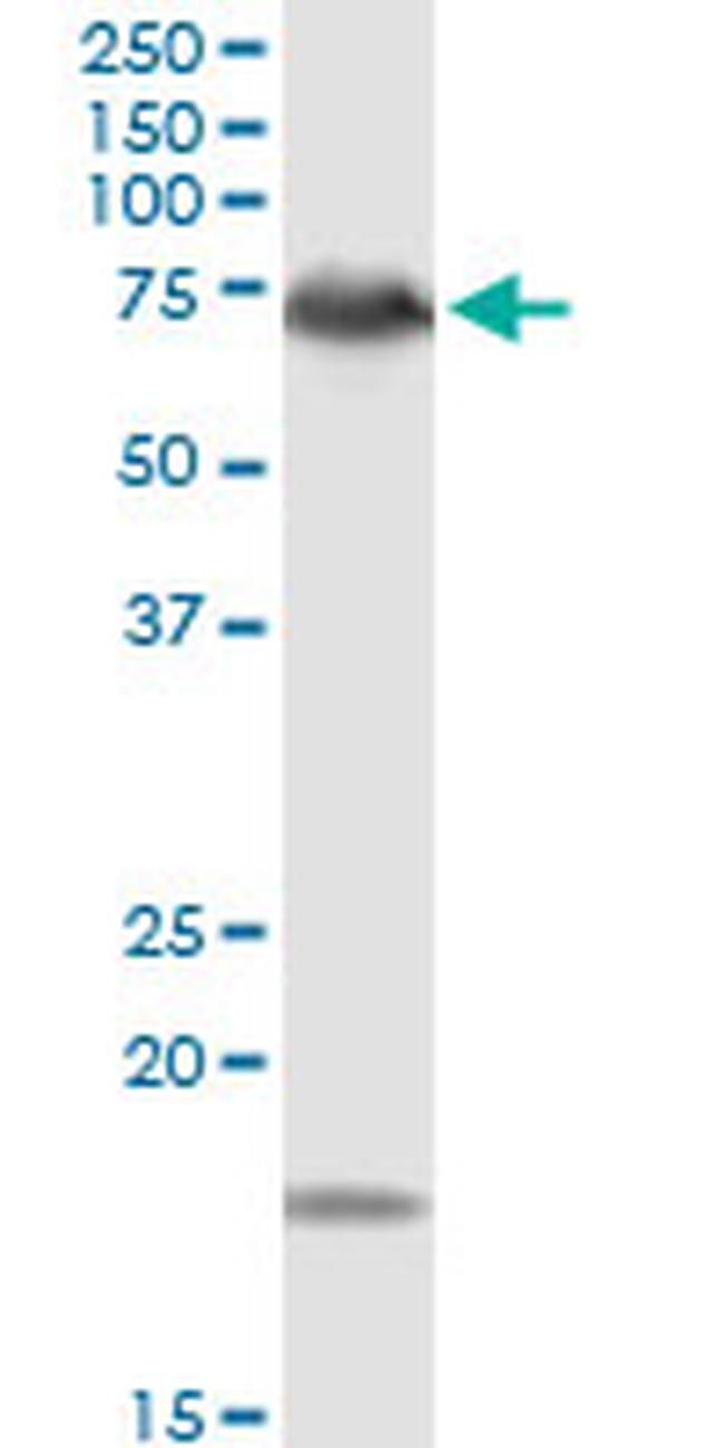 DMPK Antibody in Western Blot (WB)