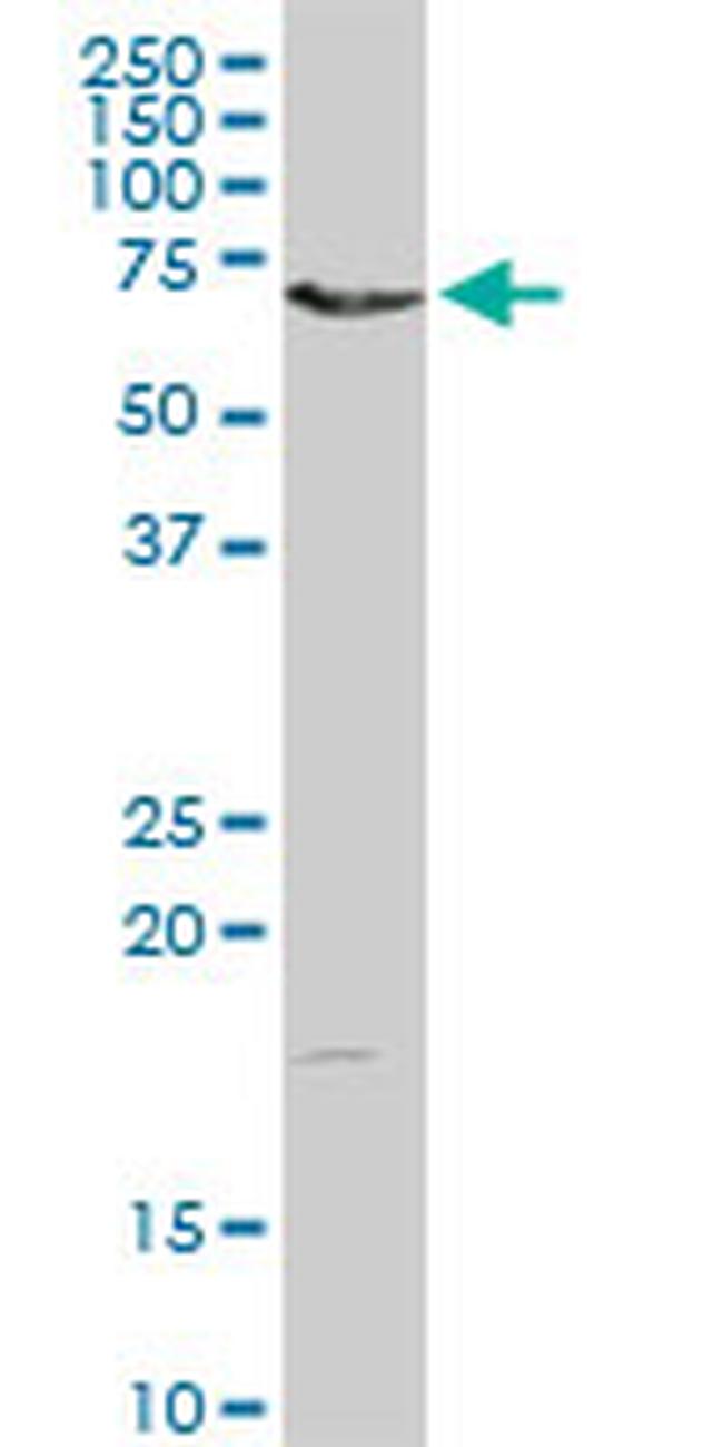 DMPK Antibody in Western Blot (WB)