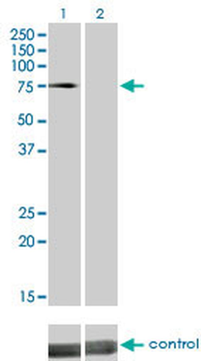 DMPK Antibody in Western Blot (WB)