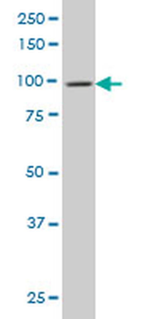 DNM2 Antibody in Western Blot (WB)