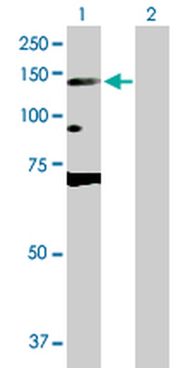 DNMT3A Antibody in Western Blot (WB)