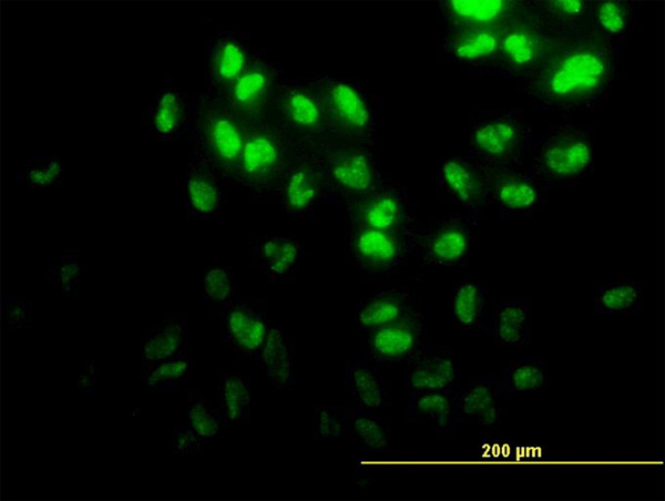 DPH2 Antibody in Immunocytochemistry (ICC/IF)