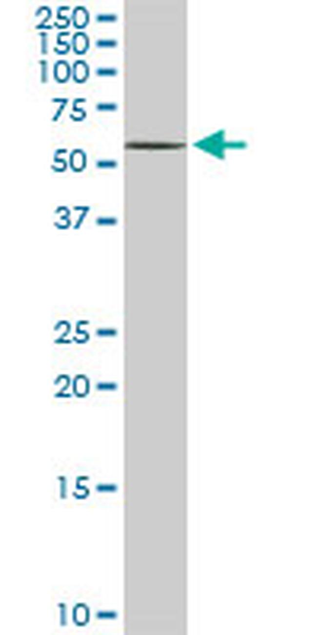 DPH2 Antibody in Western Blot (WB)