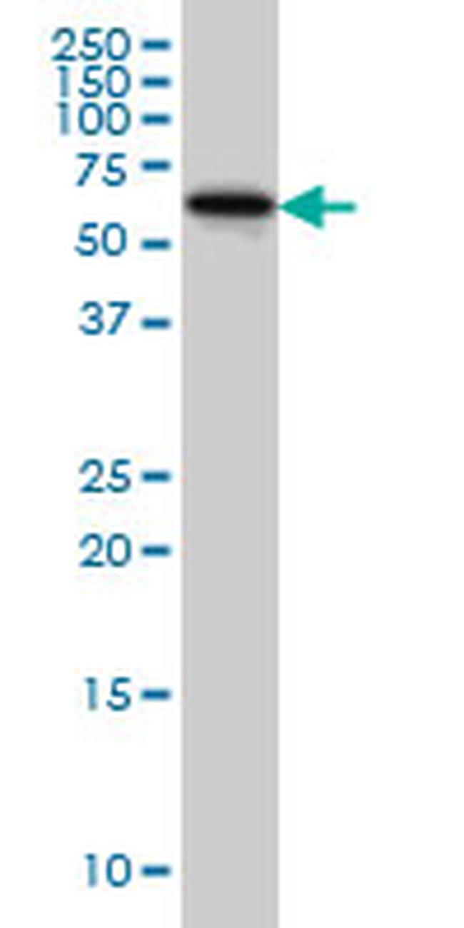 DPH2 Antibody in Western Blot (WB)