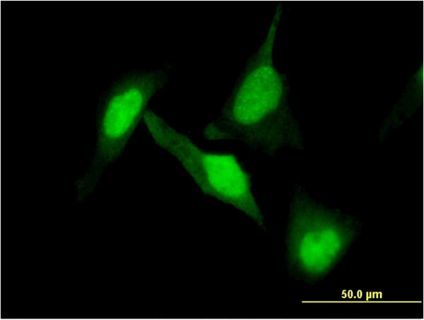 DPYSL2 Antibody in Immunocytochemistry (ICC/IF)