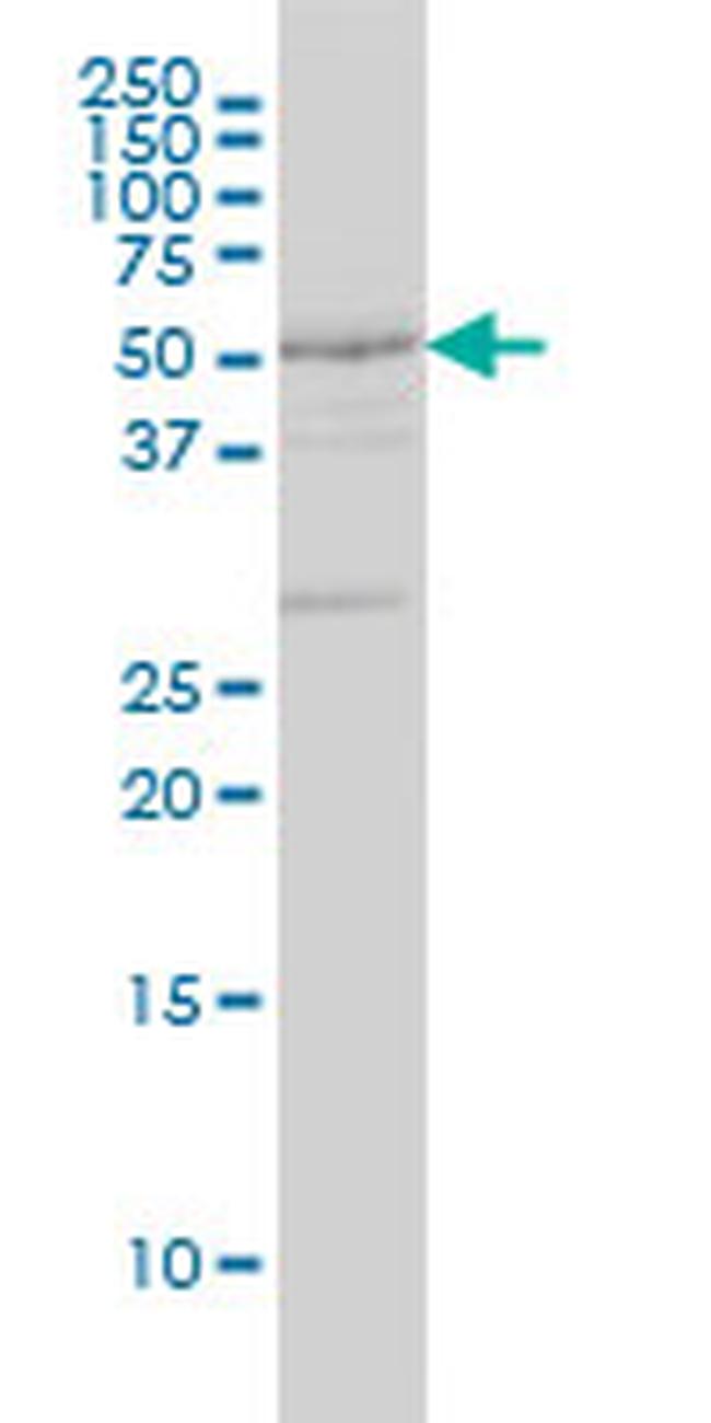 DRD2 Antibody in Western Blot (WB)