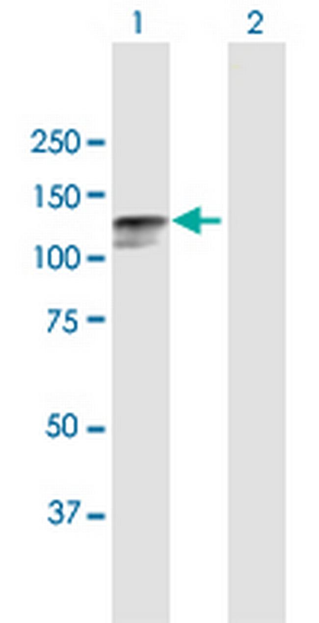 DSC2 Antibody in Western Blot (WB)