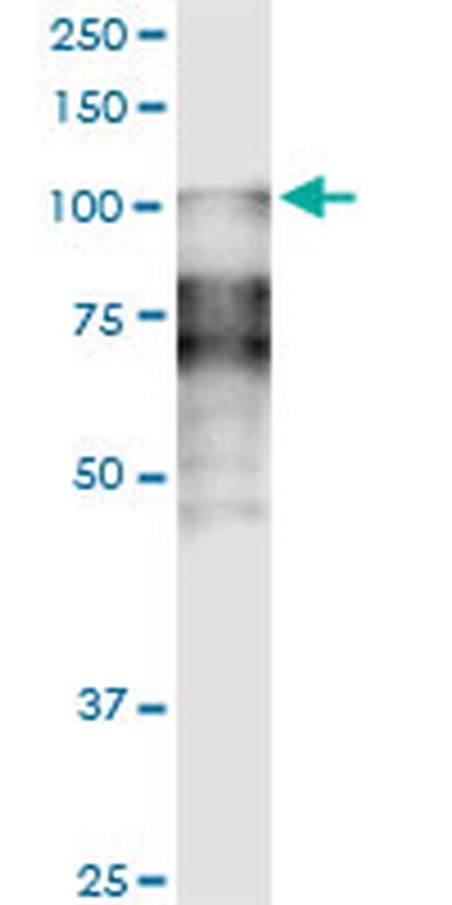 DSC2 Antibody in Western Blot (WB)