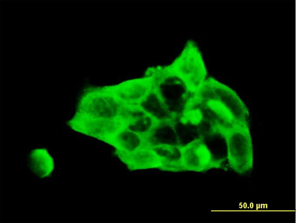 DSC3 Antibody in Immunocytochemistry (ICC/IF)