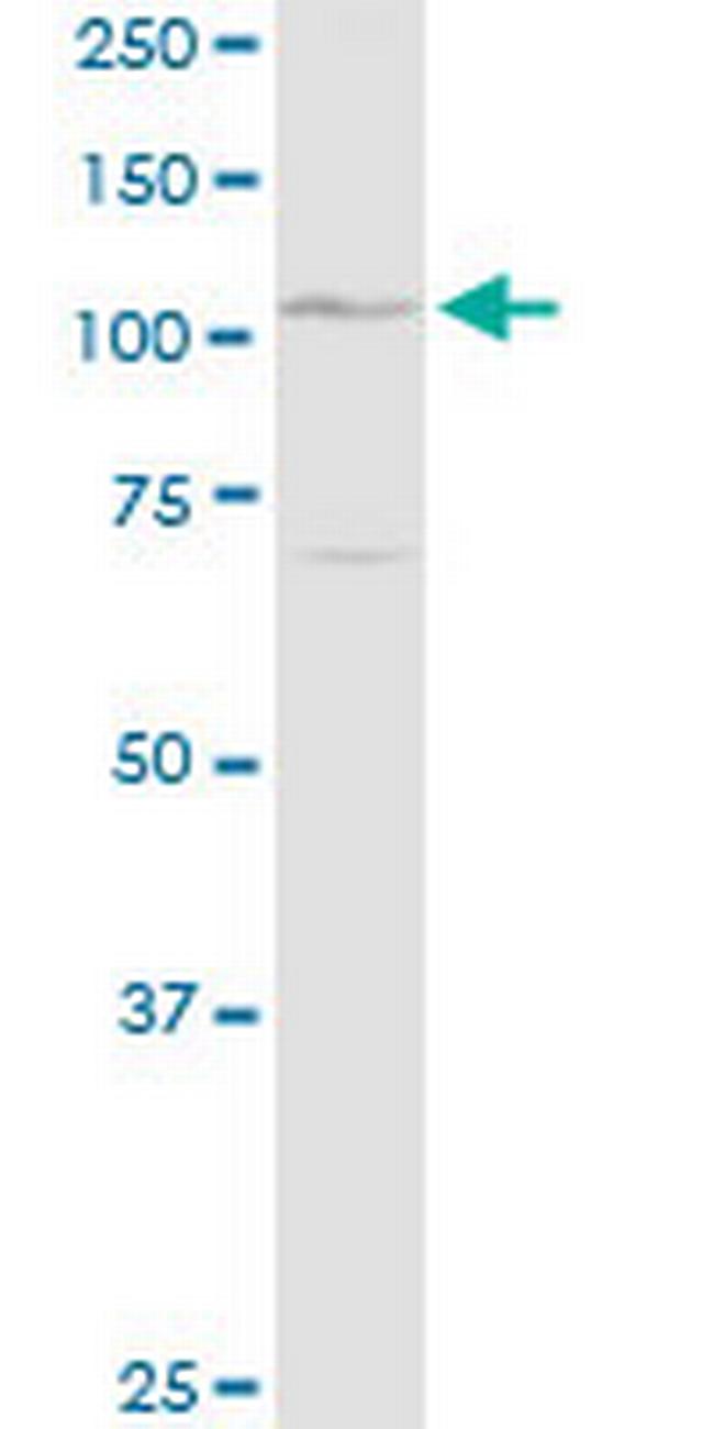 DSG1 Antibody in Western Blot (WB)