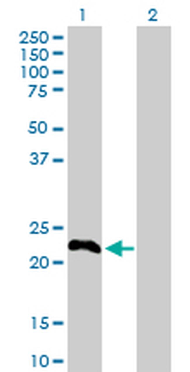 TSC22D3 Antibody in Western Blot (WB)