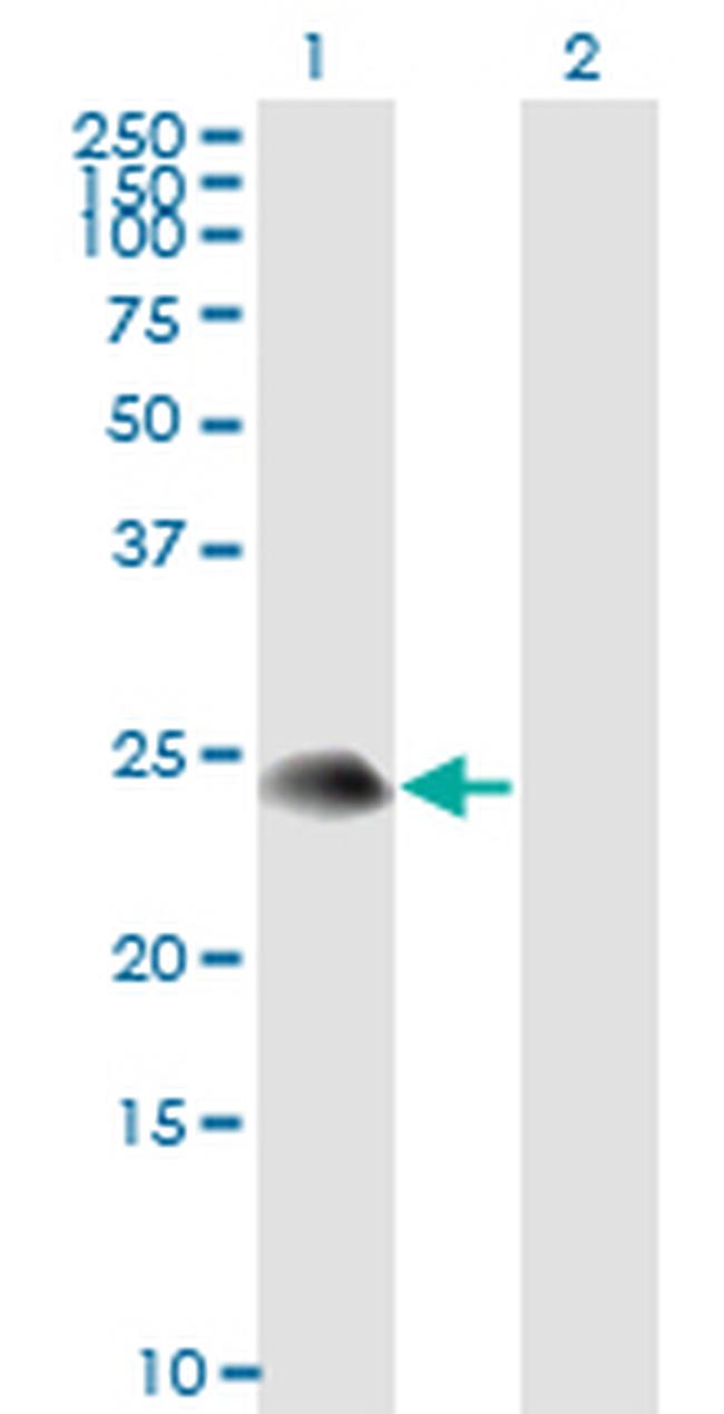 TSC22D3 Antibody in Western Blot (WB)