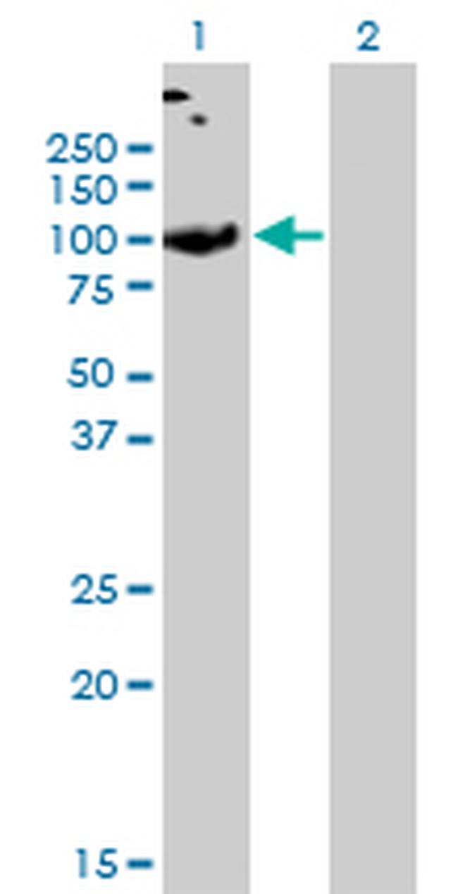 SLC26A2 Antibody in Western Blot (WB)