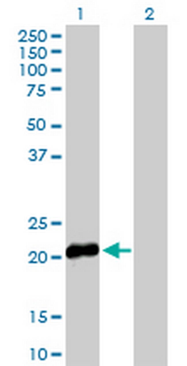 HBEGF Antibody in Western Blot (WB)