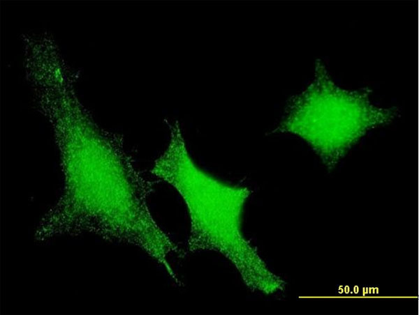 DUSP3 Antibody in Immunocytochemistry (ICC/IF)