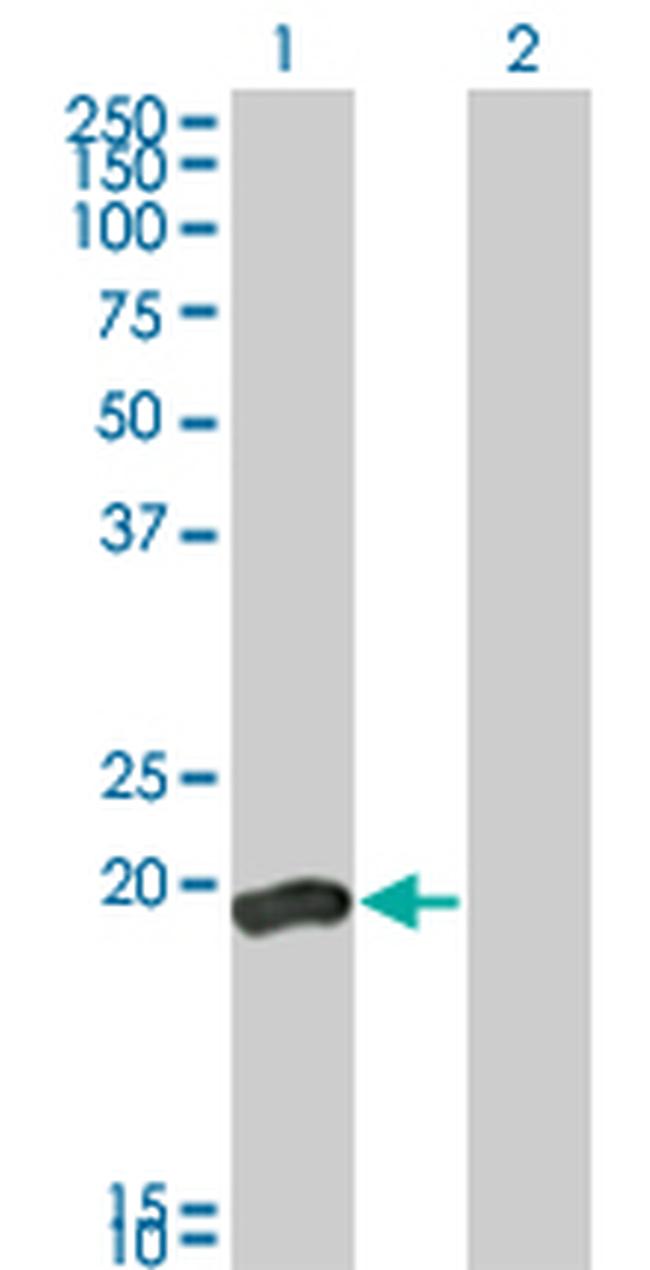 DUSP3 Antibody in Western Blot (WB)