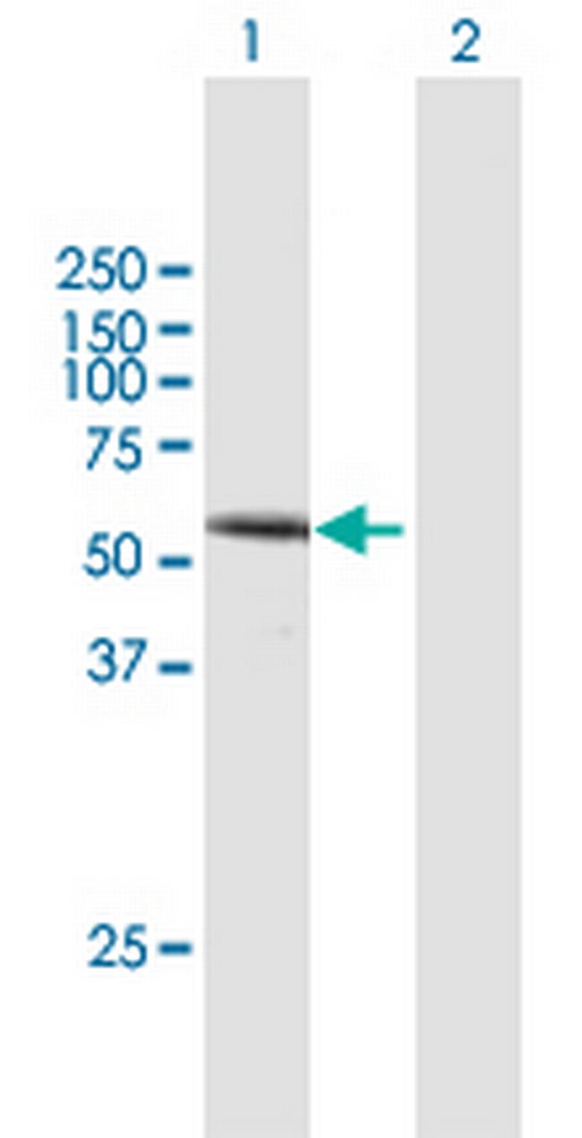 DVL1 Antibody in Western Blot (WB)