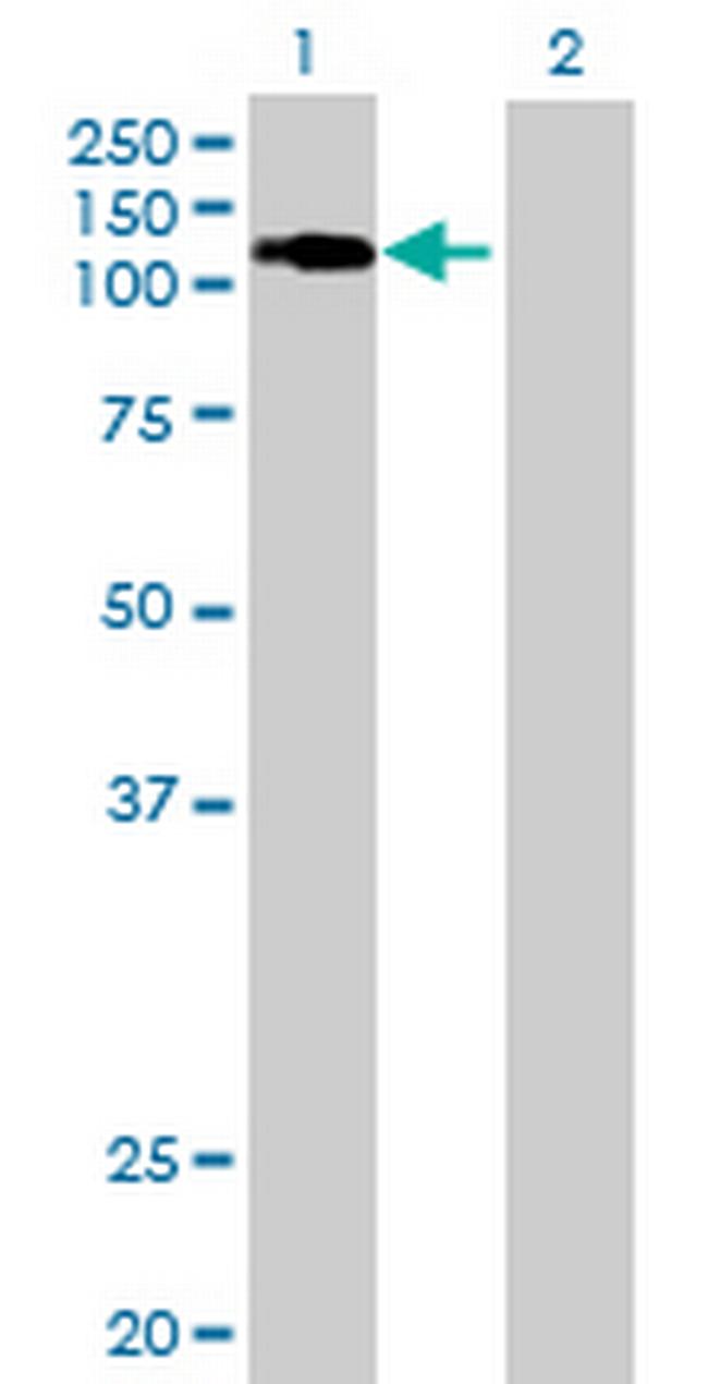 E4F1 Antibody in Western Blot (WB)