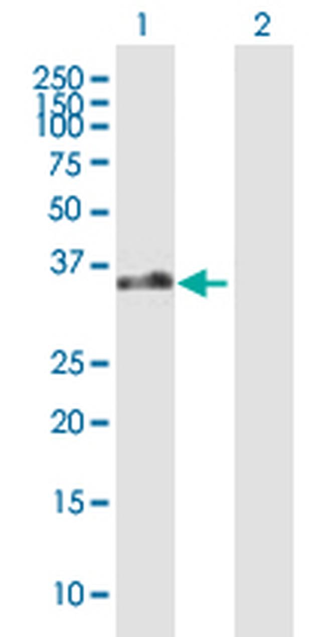 EBI2 Antibody in Western Blot (WB)