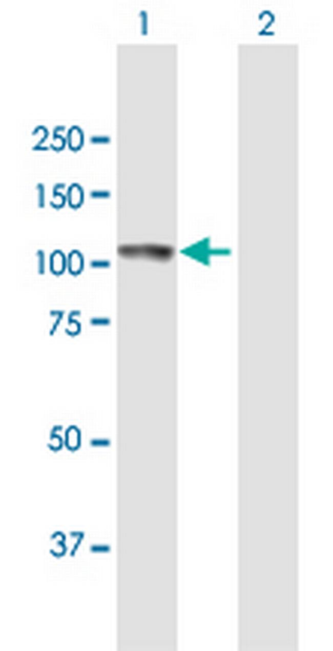 ECE1 Antibody in Western Blot (WB)