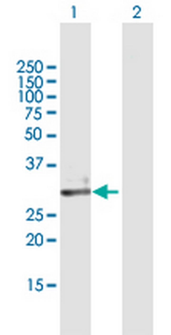 ECH1 Antibody in Western Blot (WB)