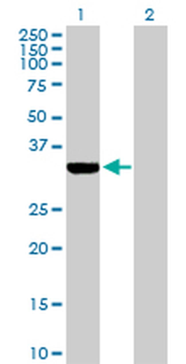 ECH1 Antibody in Western Blot (WB)