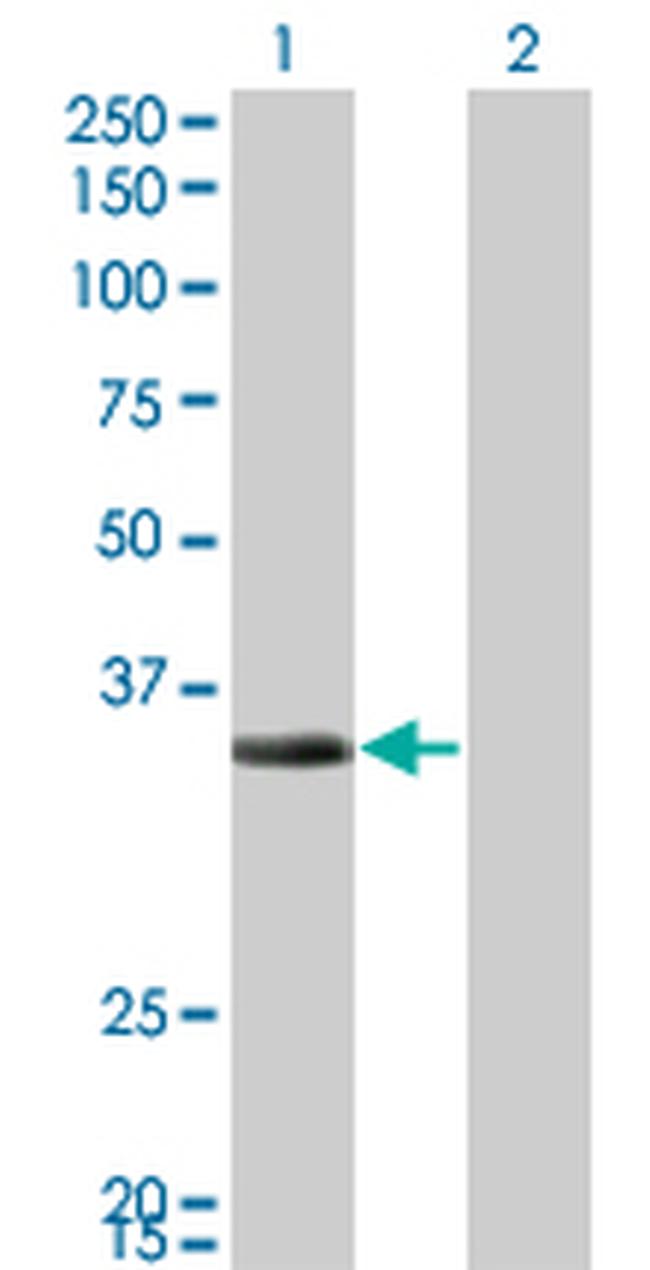 ECH1 Antibody in Western Blot (WB)