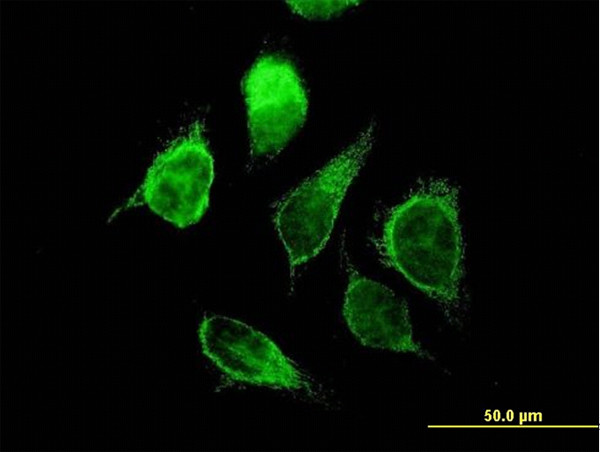 ECHS1 Antibody in Immunocytochemistry (ICC/IF)