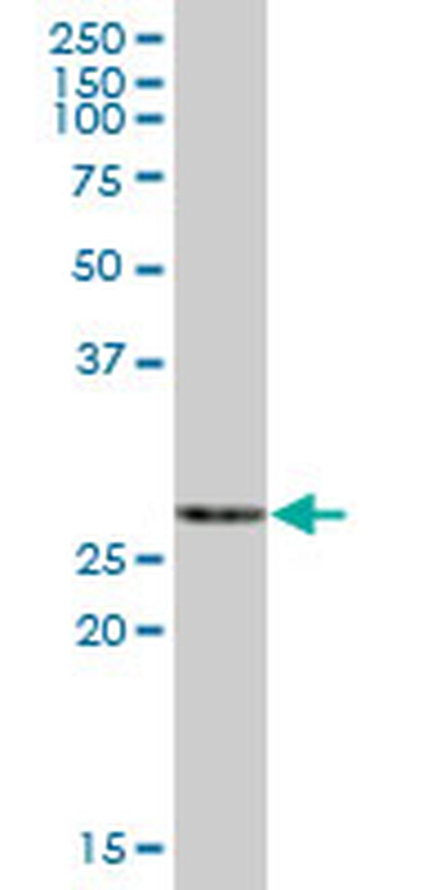 ECHS1 Antibody in Western Blot (WB)