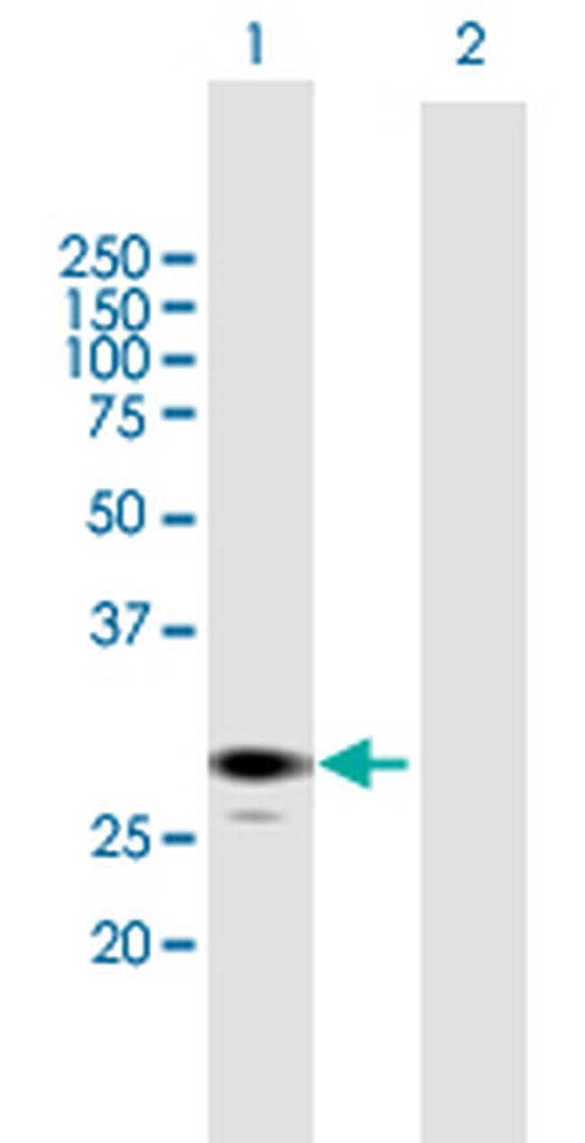 ECHS1 Antibody in Western Blot (WB)