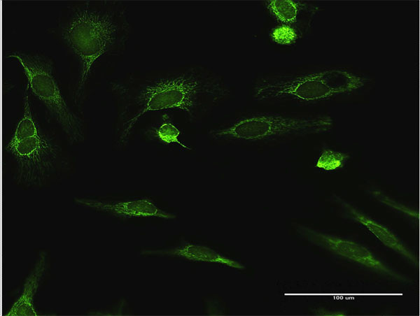 ECHS1 Antibody in Immunocytochemistry (ICC/IF)