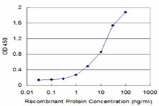 ECHS1 Antibody in ELISA (ELISA)