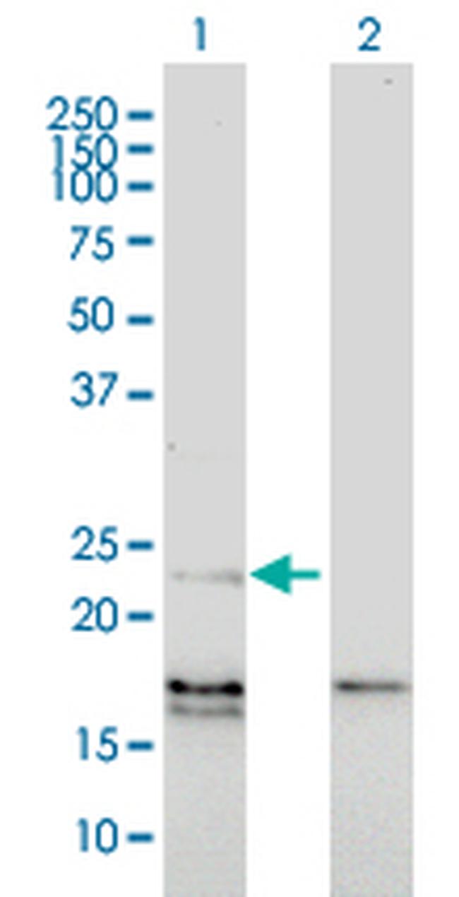 EDN1 Antibody in Western Blot (WB)