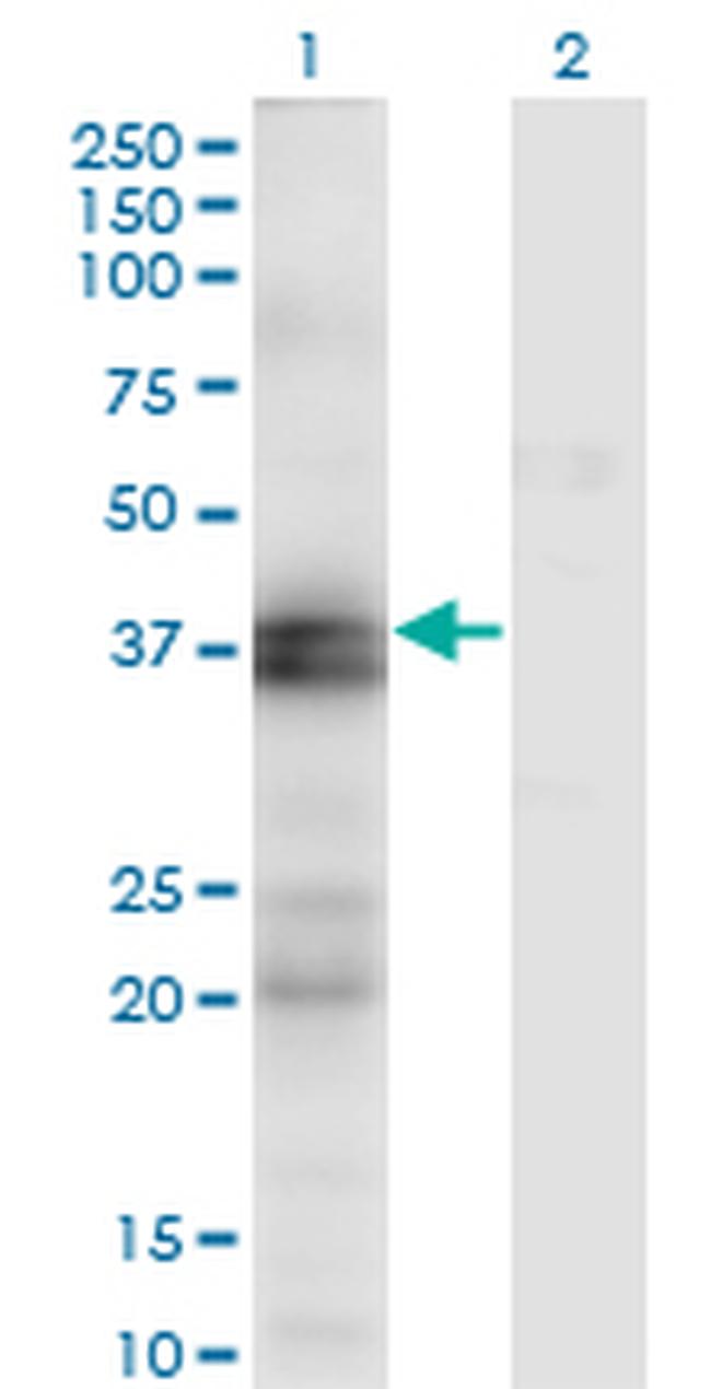 EDNRA Antibody in Western Blot (WB)