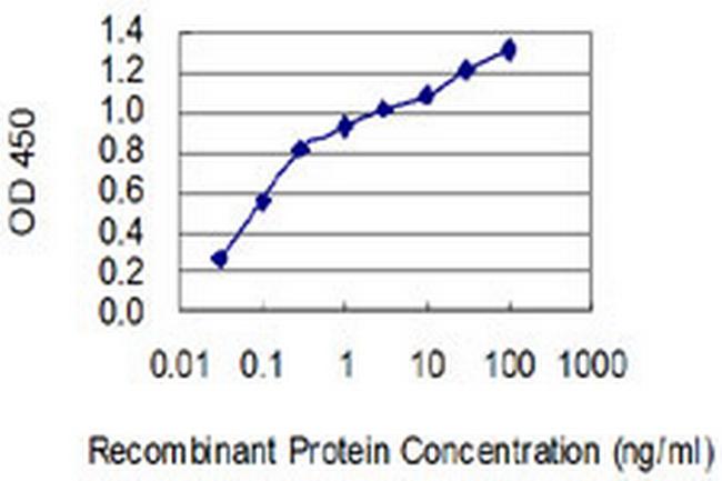 EDNRB Antibody in ELISA (ELISA)