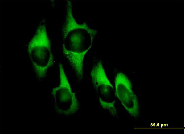 EEF1D Antibody in Immunocytochemistry (ICC/IF)